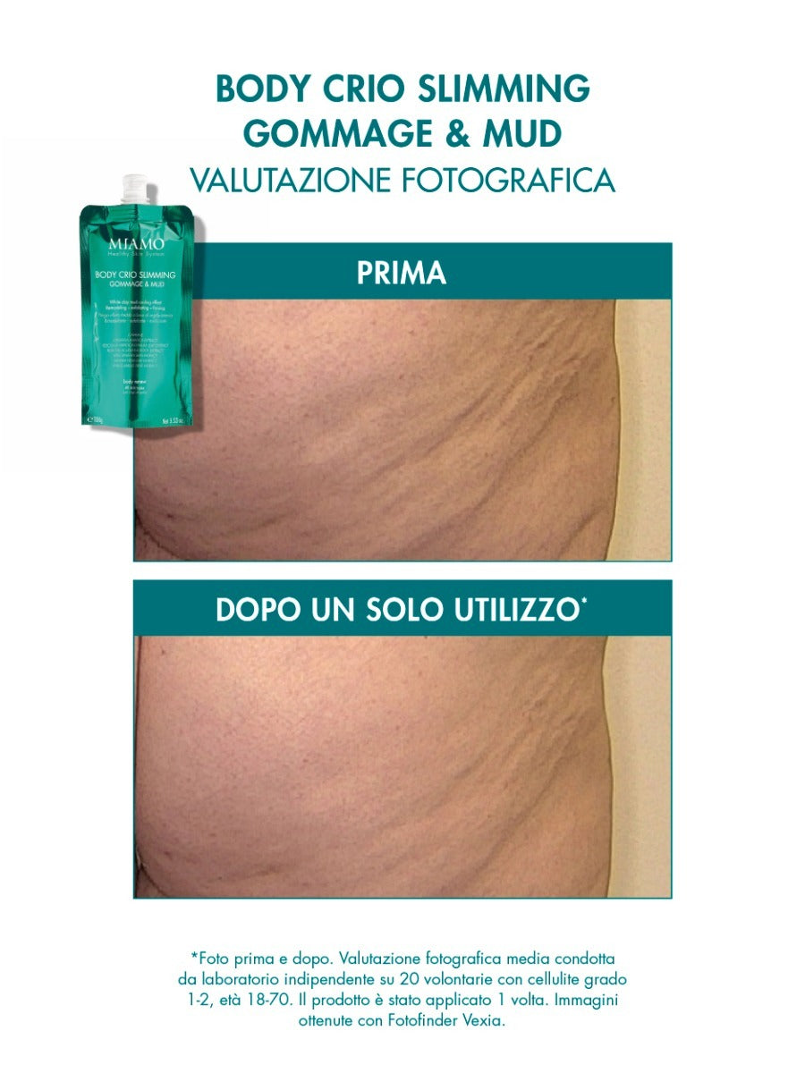 PROTOCOLLO GAMBE PESANTI
