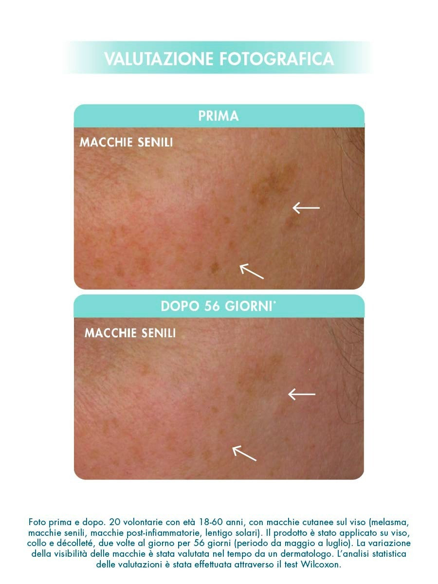 PROTOCOLLO MACCHIE DELLA PELLE - INVERNALE