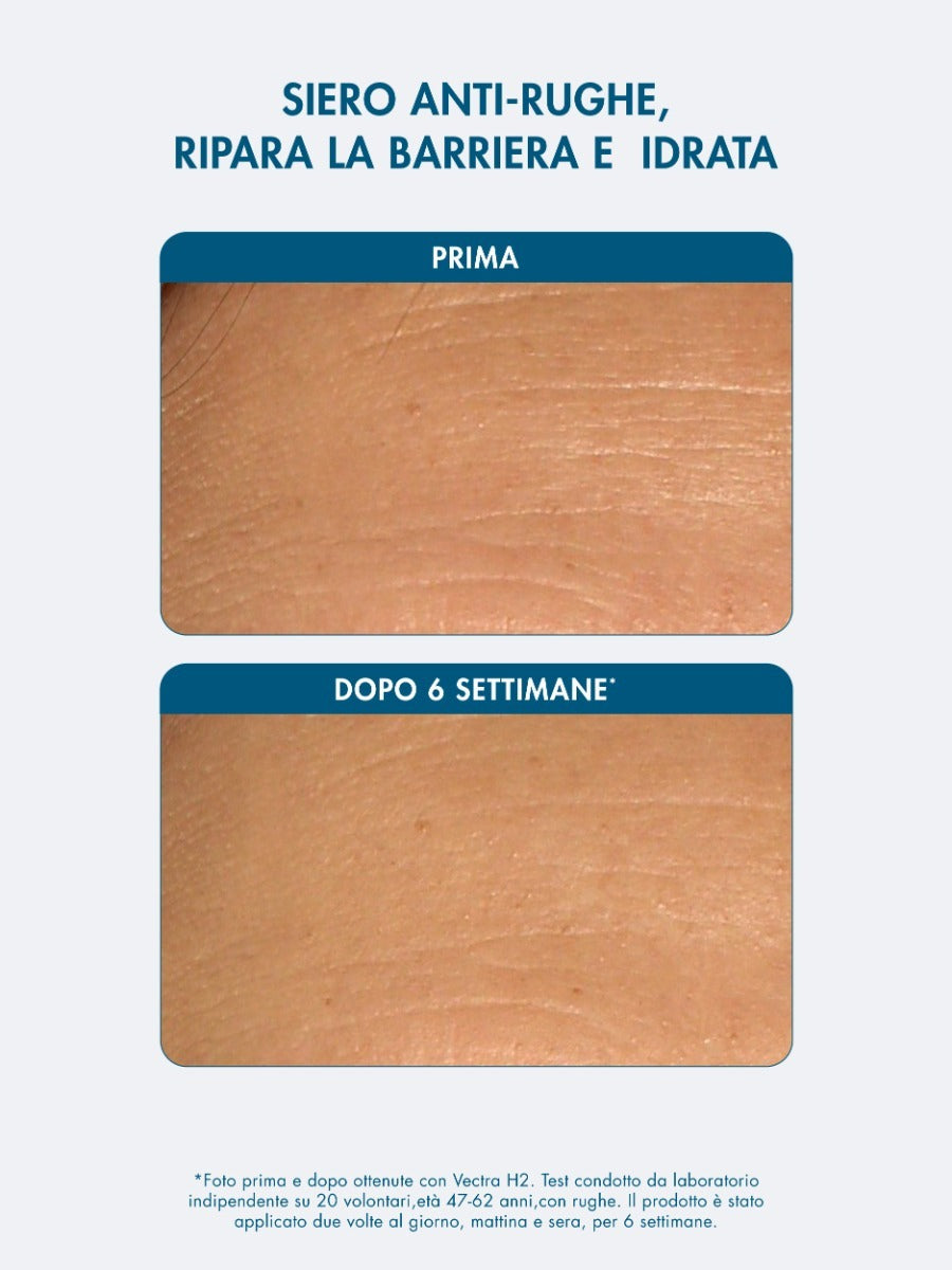PROTOCOLLO PELLE SECCA 