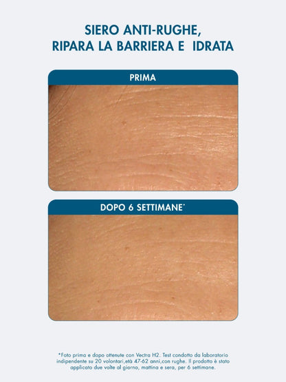 PROTOCOLLO PSORIASI 