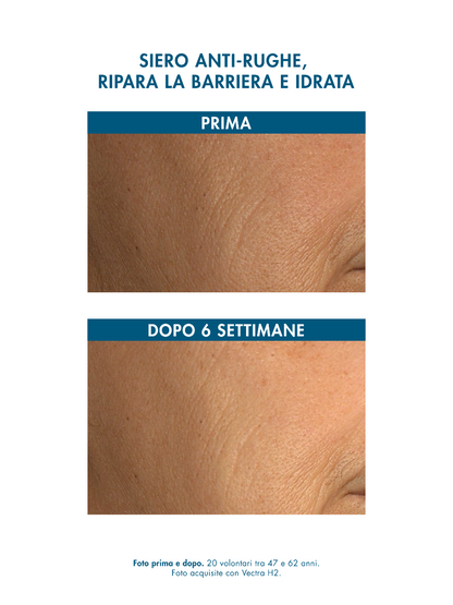 ESSENTIAL LIPIDS SERUM