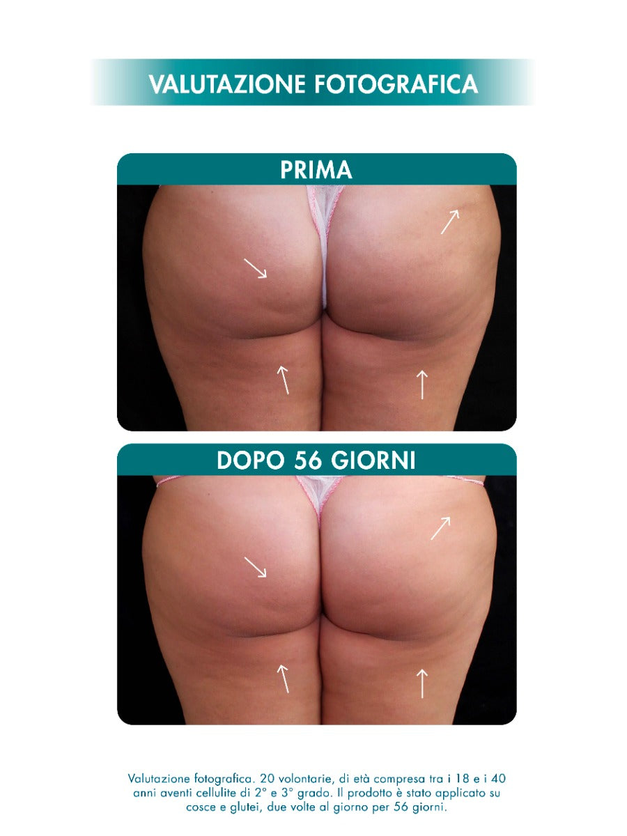 CELLULITE MULTI-ACTION EMULGEL 