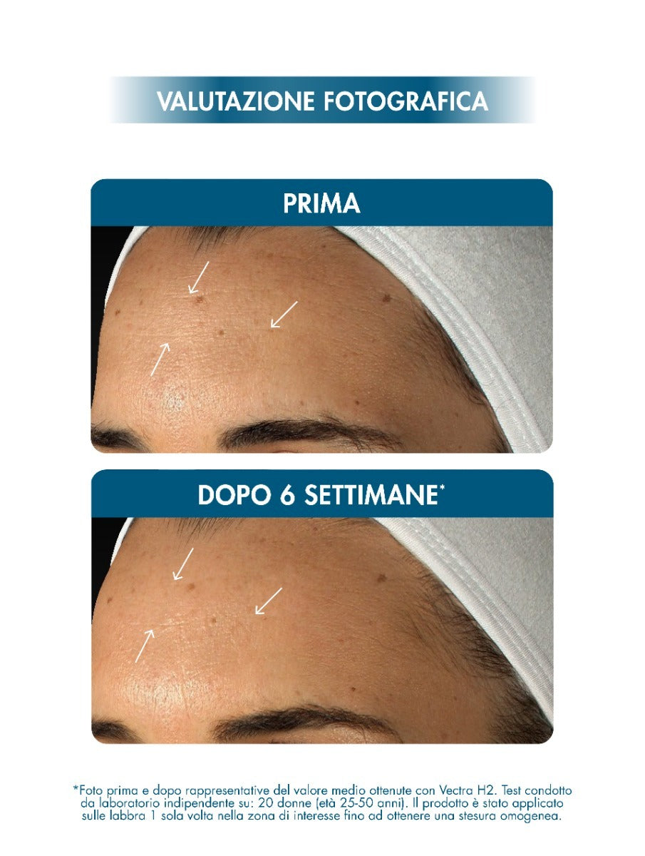 HYALURONIC 14+ FUSION SERUM 