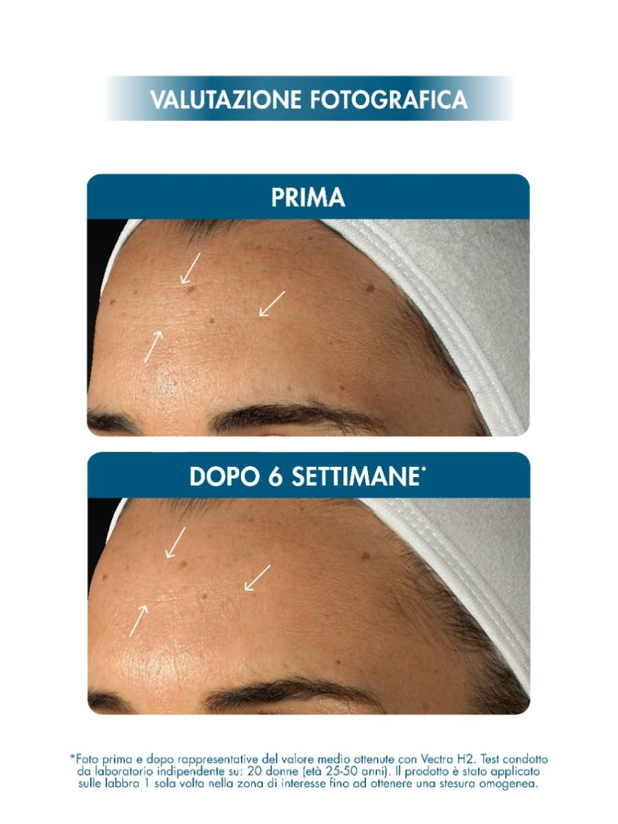 HYALURONIC 14+ FUSION SERUM 