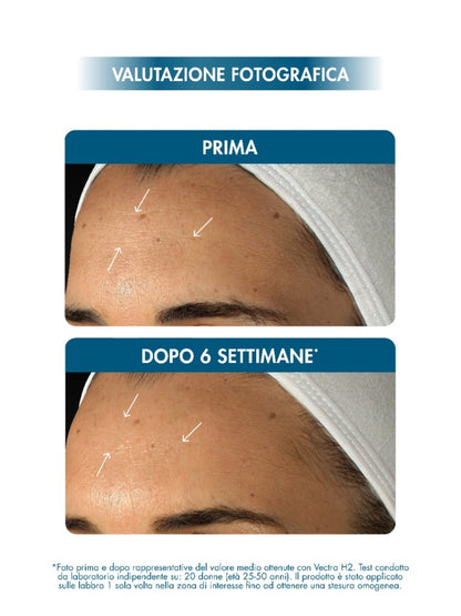 HYALURONIC 14+ FUSION SERUM 