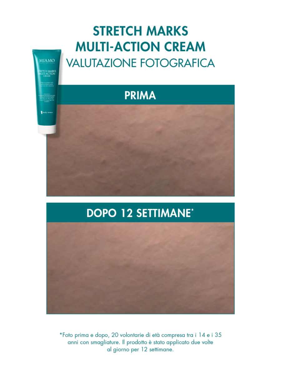 PROTOCOLLO SMAGLIATURE E GAMBE GONFIE 
