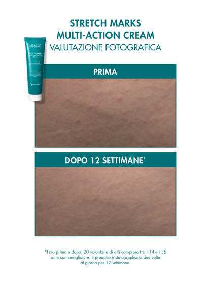PROTOCOLLO SMAGLIATURE E GAMBE GONFIE 
