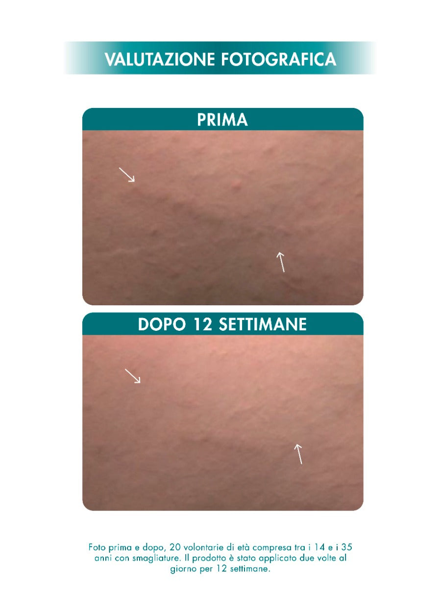 STRETCH MARKS MULTI-ACTION CREAM