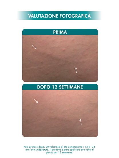 STRETCH MARKS MULTI-ACTION CREAM