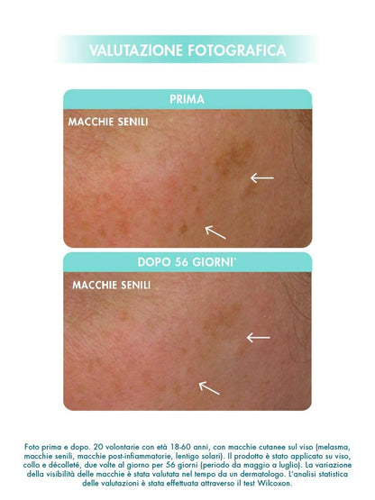 PROTOCOLLO MACCHIE DELLA PELLE - INVERNALE 