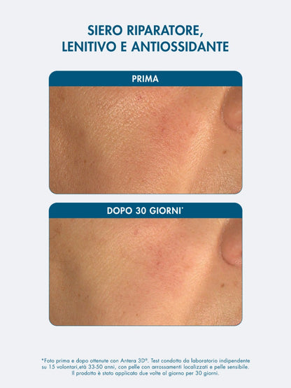 VITAMIN BLEND 15% RECOVERY SERUM